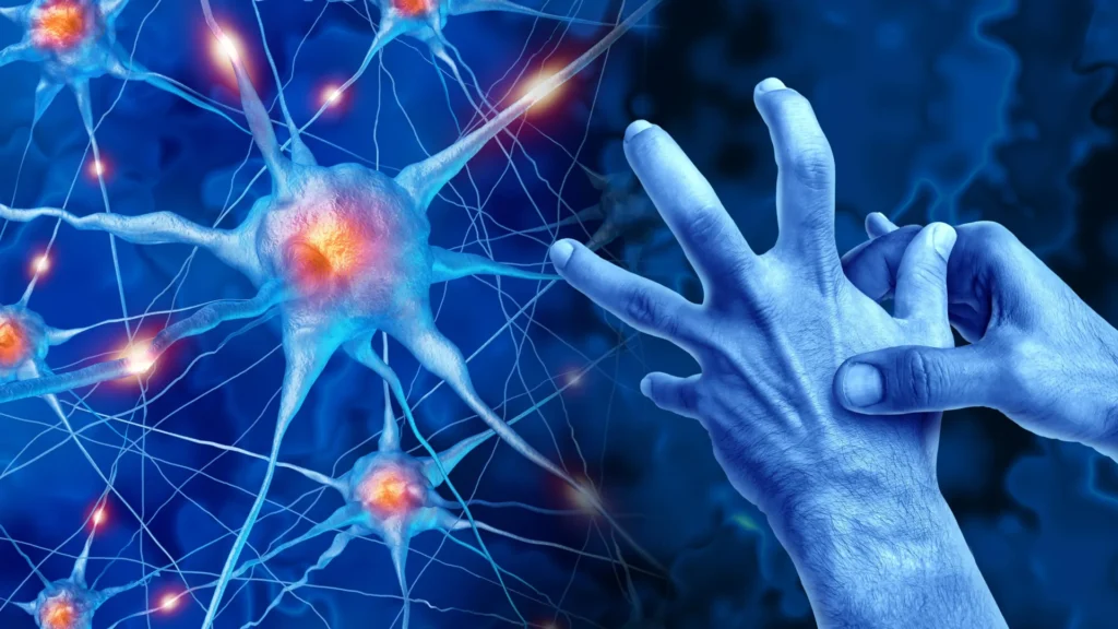 parkinsons-disease-neuroscience-body-movement-disorder.webp.webp